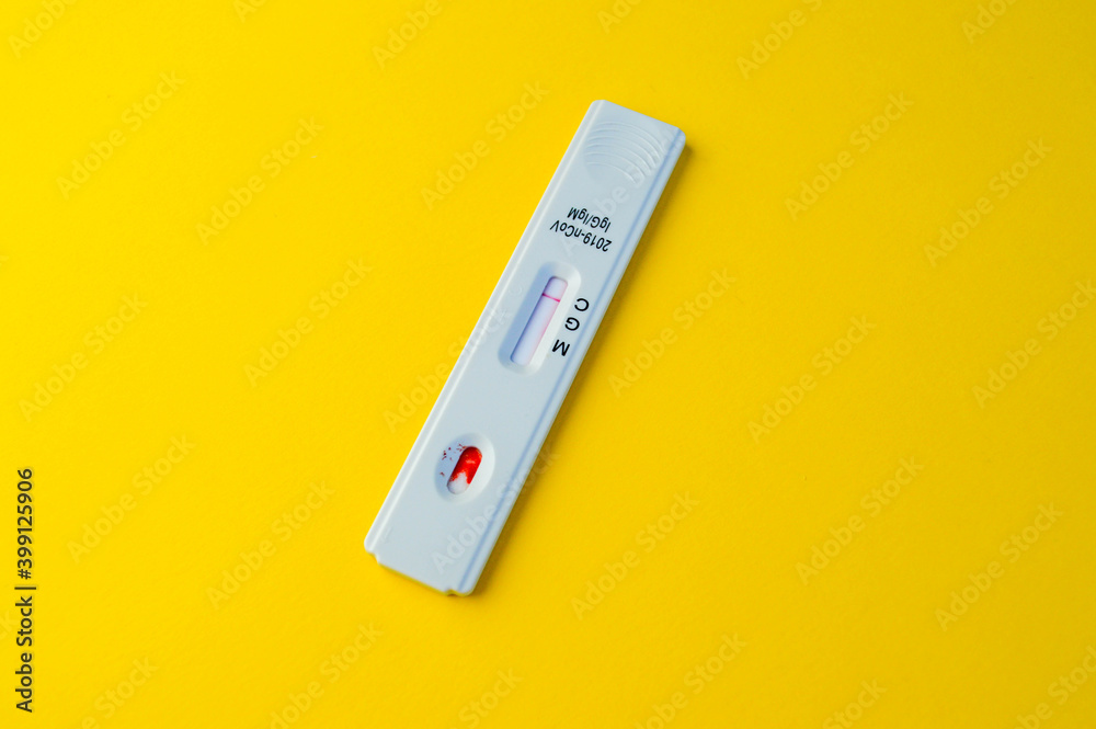 Negative test result by using rapid test for COVID-19, quick fast antibody point of care testing. Lab performing rapid diagnostic test for antibodies to detect presence of antigens COVID-19 disease Negative test result by using rapid test for COVID-19, quick fast antibody point of care testing. Lab performing rapid diagnostic test for antibodies to detect presence of antigens COVID-19 disease