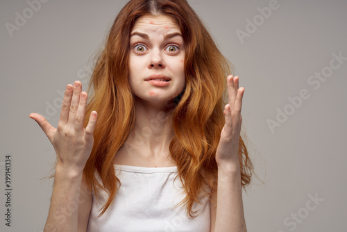 Fotografie woman with loose hair acne on her face acne gesturing with her hands