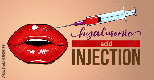 Hyaluronic acid filler injection or mesotherapy procedures. Beautiful red female lips. Cosmetology moisturizing procedures and beauty concept banner. Vector hand drawn illustration for advertisement.