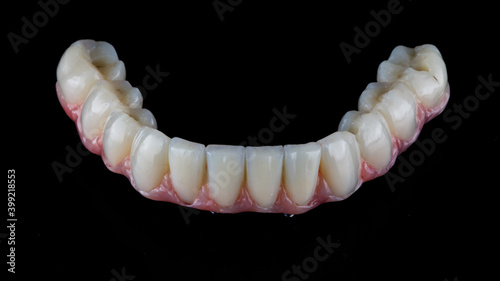 ceramic dental prosthesis with artificial gum for the lower jaw, filmed on a black background