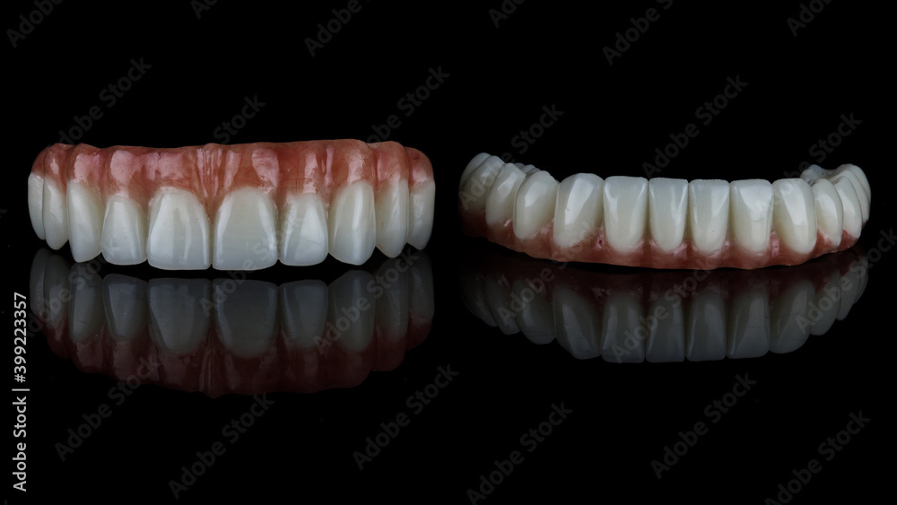 two excellent dental prostheses for the patient's upper and lower jaws on a black background with reflection two excellent dental prostheses for the patient's upper and lower jaws on a black background with reflection
