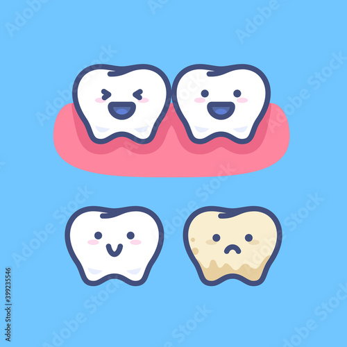 Vector set of cute cartoon little teeth on blue background. Illustration of smiling healthy tooth characters and sad tooth character with dental plaque and tartar