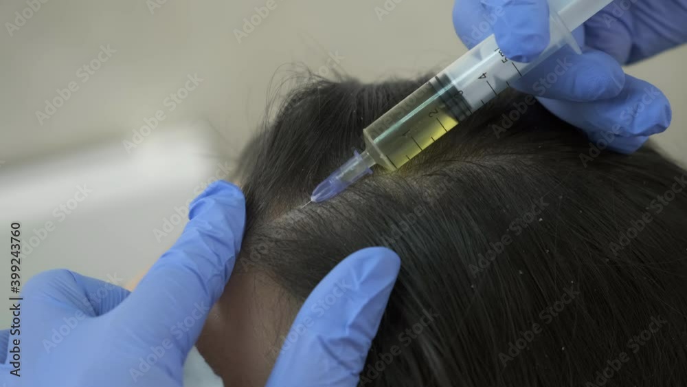 Doctor trichologist making injections mesotherapy with vitamins in