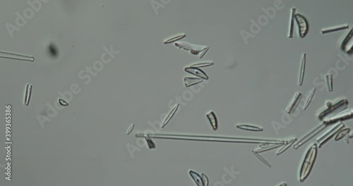 Diatoms from the sea under the microscope 100x photo
