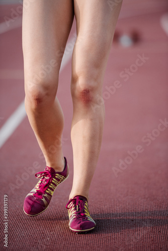 Female athlete with injured knees walking on race track photo