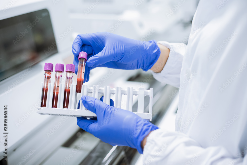 Scientist wear glove holding test tube in sample rack to check qulity of sample. Scientist wear glove holding test tube in sample rack to check qulity of sample.