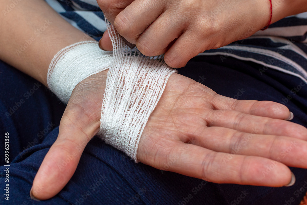 A young woman in the open air independently bandages a damaged wrist with a  medical gauze bandage. Close-up. Photos | Adobe Stock