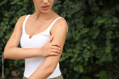 Woman scratching arm with insect bites in park, closeup. Space for text