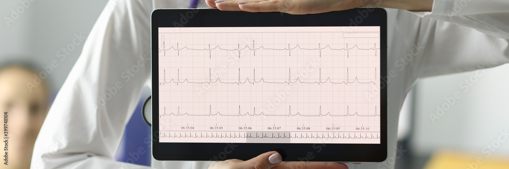 Doctor holding tablet with electrocardiogram in clinic closeup. Diagnosis of heart rhythm disorders concept Doctor holding tablet with electrocardiogram in clinic closeup. Diagnosis of heart rhythm disorders concept