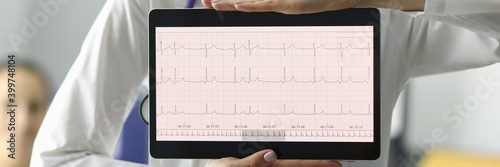 Doctor holding tablet with electrocardiogram in clinic closeup. Diagnosis of heart rhythm disorders concept