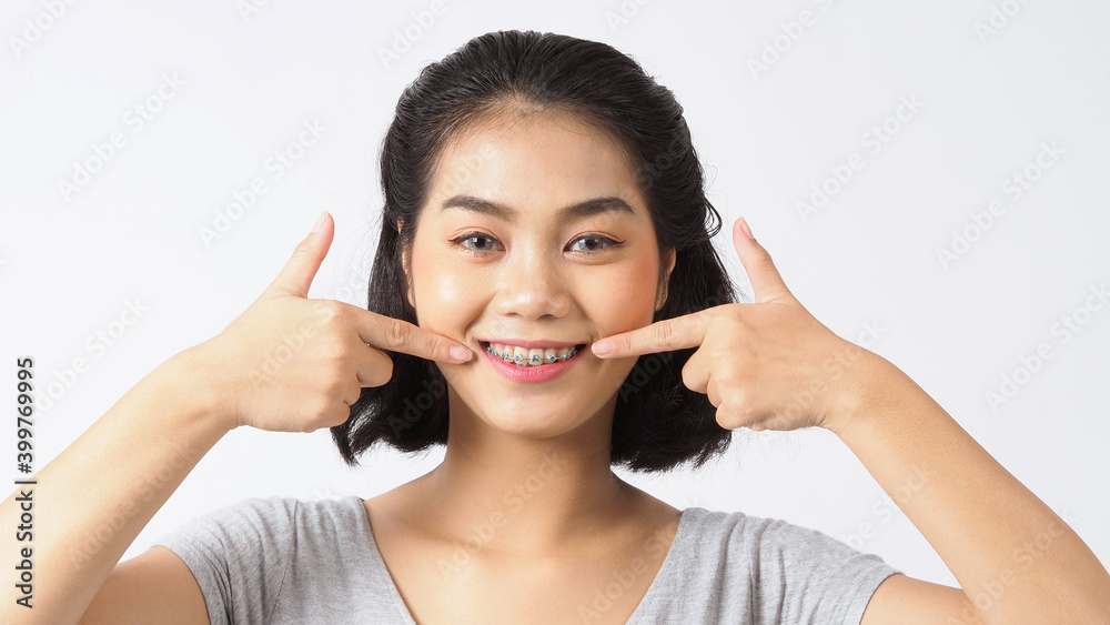 Dental brace teen girl smiling looking on a camera. white teeth with blue braces. Dental care. Asian woman smile with orthodontic accessories. Cosmetic dentistry, orthodontics treatment. studio shot. Dental brace teen girl smiling looking on a camera. white teeth with blue braces. Dental care. Asian woman smile with orthodontic accessories. Cosmetic dentistry, orthodontics treatment. studio shot.
