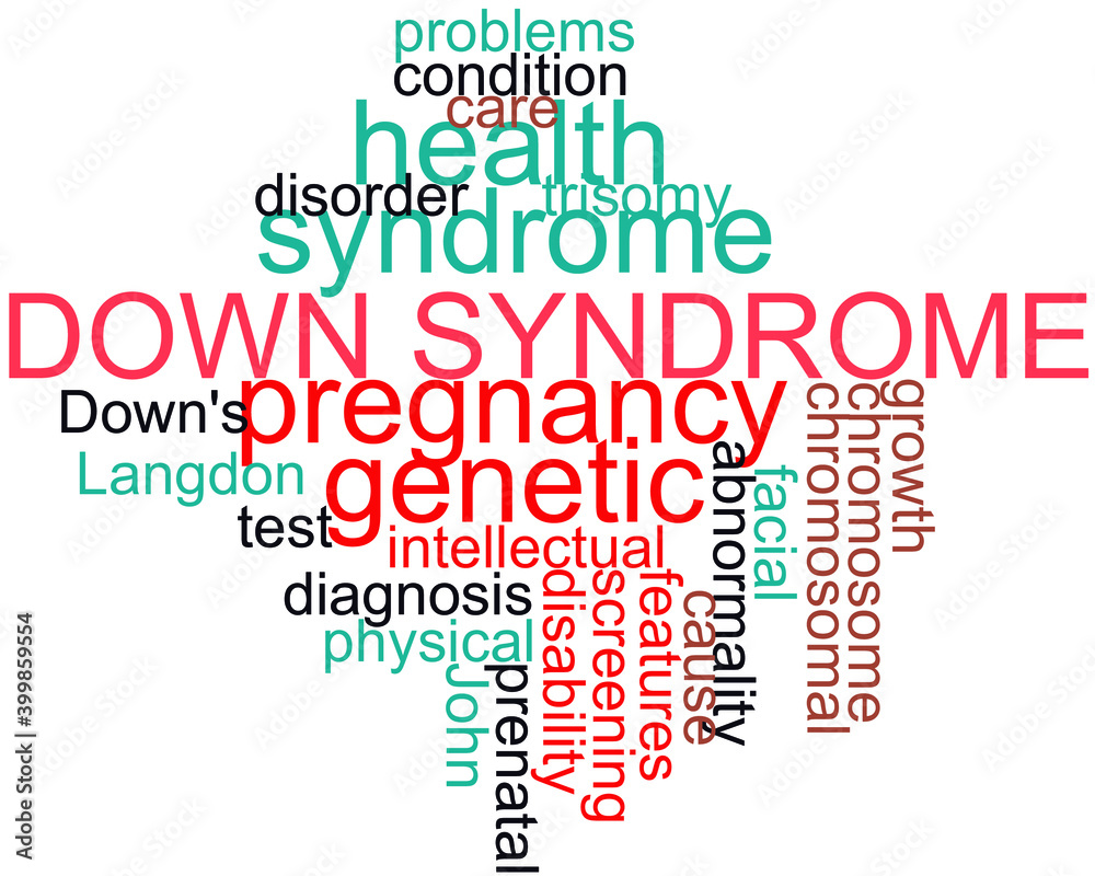 Down Syndrome Typography vector word cloud. Down Syndrome Typography vector word cloud.