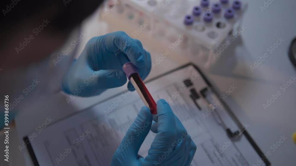 Doctor holding Coronavirus 2019-nCoV blood sample. Concept of vaccination, Covid 19 diagnostic. Diagnosis and laboratory. Scientist with positive coronavirus test. Detection virus infected. Pandemic Doctor holding Coronavirus 2019-nCoV blood sample. Concept of vaccination, Covid 19 diagnostic. Diagnosis and laboratory. Scientist with positive coronavirus test. Detection virus infected. Pandemic