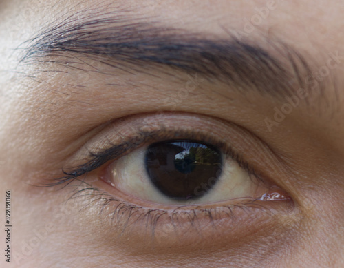 Close up of one eye, young Asian woman has beautiful eyebrows, concept of treatment of capillary iris.