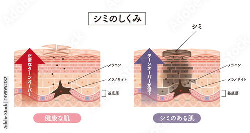 Cross section of the skin 2 front