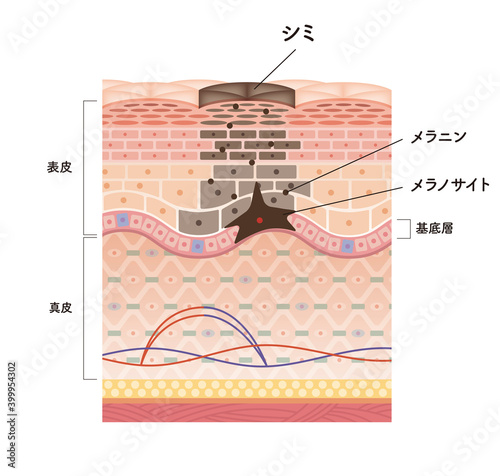 Cross section of the skin 9 front