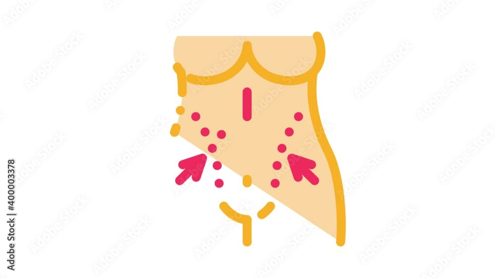 Tummy Protection Animation tummy tuck Icon Animation. color tummy tuck animated icon on white ...