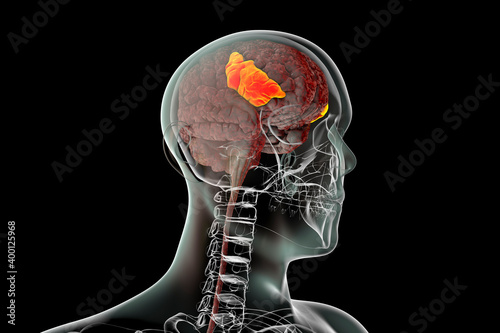 Human brain in the body with highlighted inferior frontal gyrus