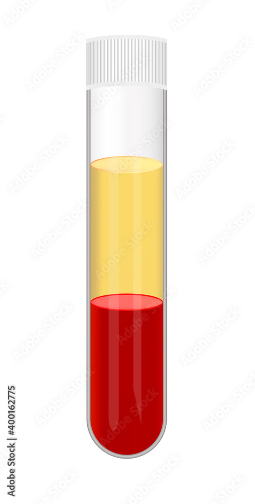 Vector illustration of a test tube with blood after separation of plasma isolated on white background. Platelet-rich plasma, platelet-poor plasma, PRP, PPP. Blood fractionation, centrifuging the blood Vector illustration of a test tube with blood after separation of plasma isolated on white background. Platelet-rich plasma, platelet-poor plasma, PRP, PPP. Blood fractionation, centrifuging the blood