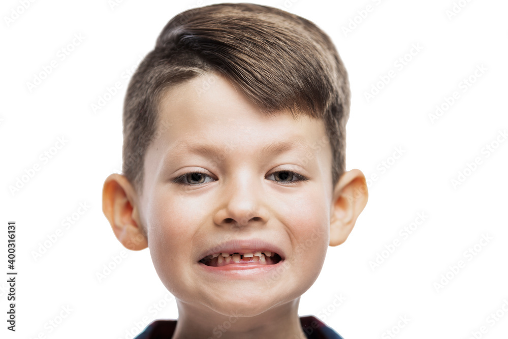 The boy who has lost his front tooth is smiling. Dental care. Close-up. Isolated on white background. The boy who has lost his front tooth is smiling. Dental care. Close-up. Isolated on white background.