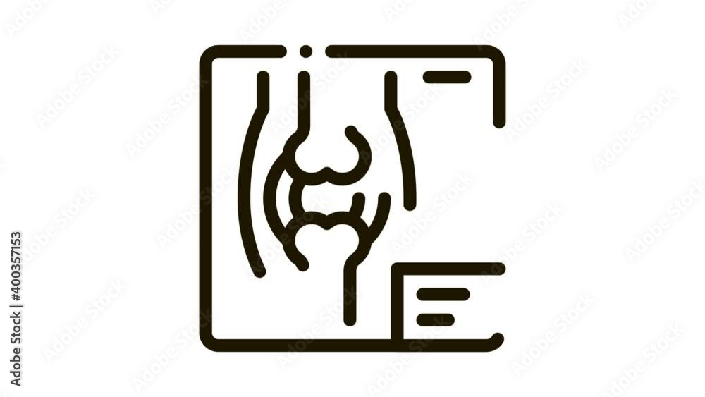 bone x-ray Icon Animation. black bone x-ray animated icon on white background bone x-ray Icon Animation. black bone x-ray animated icon on white background