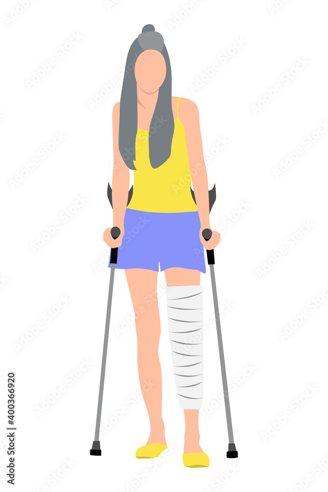 A beautiful girl with long hair in a yellow shirt and blue shorts with a cast on her leg and crutches in her hands. Disability concept, physical injury. Broken leg, trauma A beautiful girl with long hair in a yellow shirt and blue shorts with a cast on her leg and crutches in her hands. Disability concept, physical injury. Broken leg, trauma