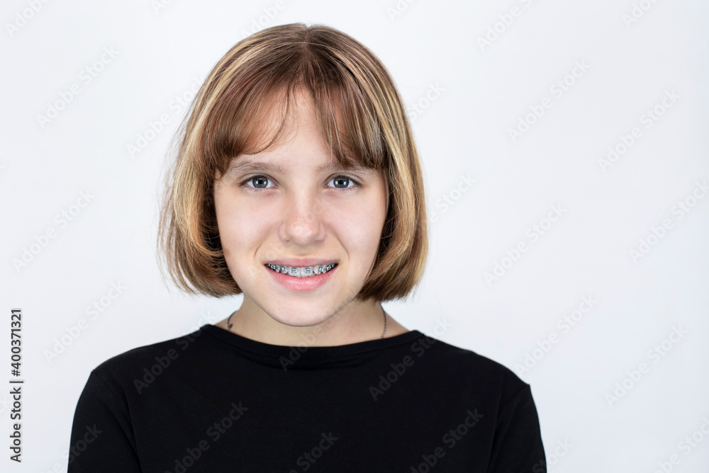 Teen girl with braces on teeth with elastic bands, focus on eyes and braces. The girl on a light background smiles, braces on teeth are visible Teen girl with braces on teeth with elastic bands, focus on eyes and braces. The girl on a light background smiles, braces on teeth are visible