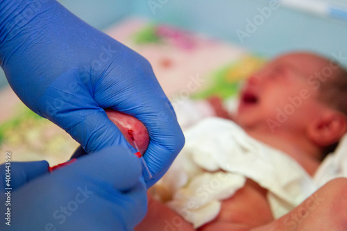Принти на полотні Newborn blood spot or heel prick test (the Guthrie test)