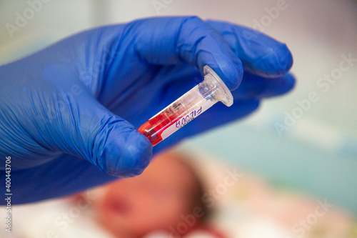 Billede på lærred Newborn blood spot or heel prick test (the Guthrie test)