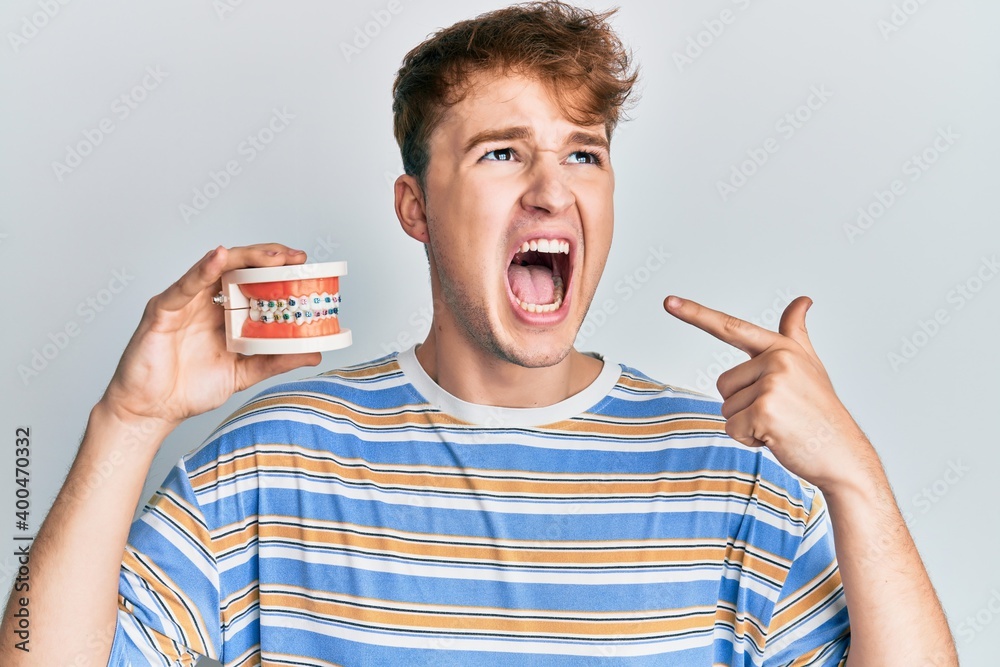 Young caucasian man holding denture angry and mad screaming frustrated and furious, shouting with anger looking up.