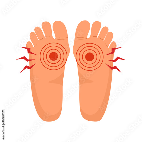 Foot pain concept vector illustration on white background. Man or woman feel painful at sole of the foot area.