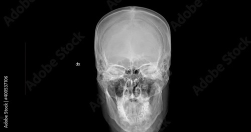 Stop motion radiographs of a front and side human skull. 4K horror background