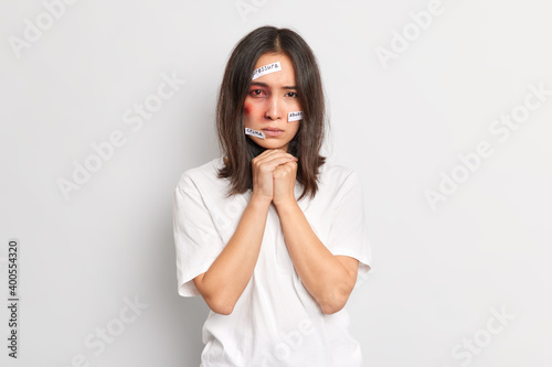 Indoor shot of young woman being struck abuse victim has bruise under eye keeps hands together looks hopeless at camera faces domestic violence abuse pressure poses in t shirt over white wall © wayhome.studio 