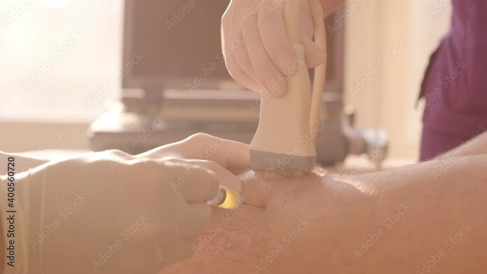 Platelet rich plasma PRP used in treatment of knee. Injection rich plasma PRP
