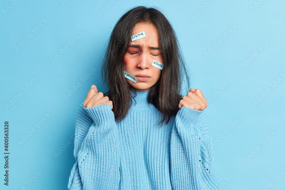 Abused assaulted woman clenches fists stands with big hematoma bruise on face expresses fear and despair being beaten closes eyes wears blue jumper poses indoor. Violence and feminism concept Abused assaulted woman clenches fists stands with big hematoma bruise on face expresses fear and despair being beaten closes eyes wears blue jumper poses indoor. Violence and feminism concept