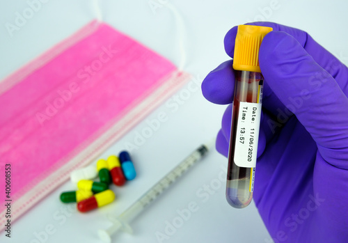Real blood sample with anticoagulant and blank sticker hold in a hand with glove. Face mask, pills and syringe on the blurred background. Concept.
