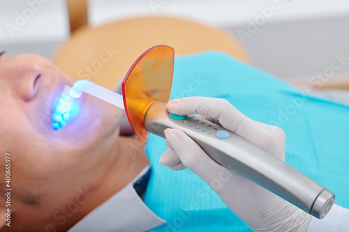 Close-up image of dentist using curing light is a piece of dental equipment that is used for polymerization of light cure resin based composites photo