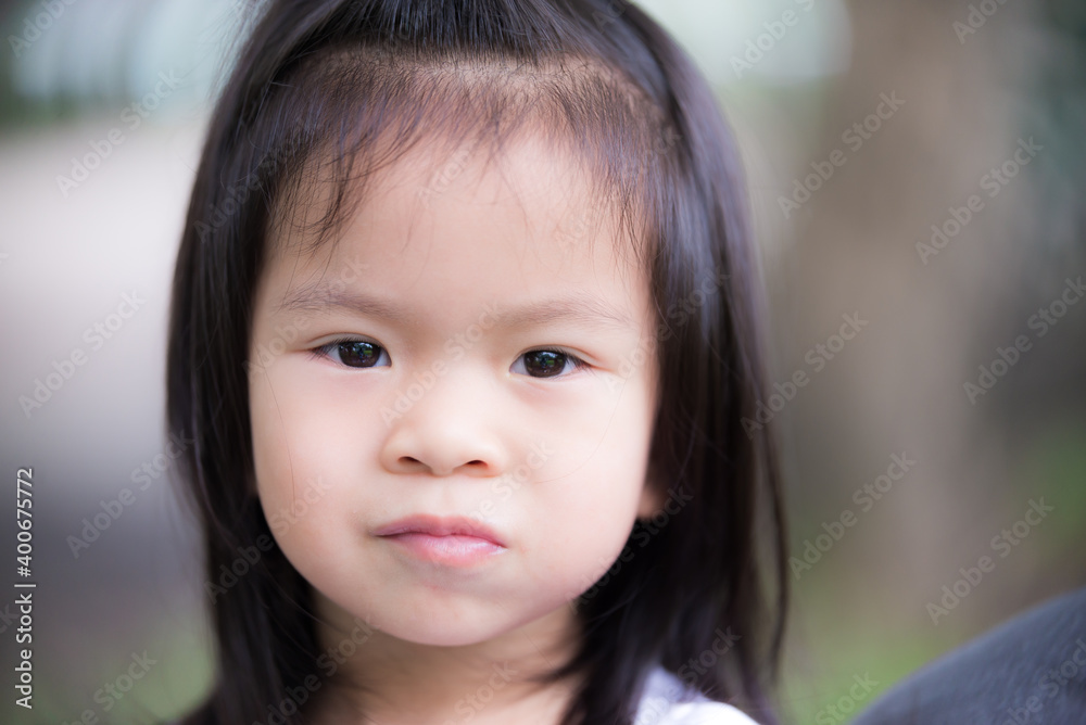 Closeup Asian little child suck food on the cheek. Tooth decay concept.