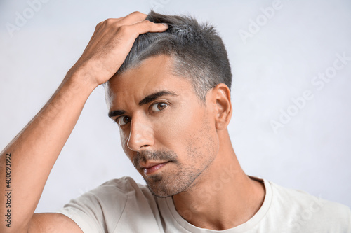 Man with graying hair on li...