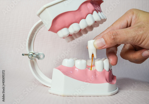 Hand extracting a tooth model,Hand pulling out a tooth model.Hand drawing a tooth model. 
