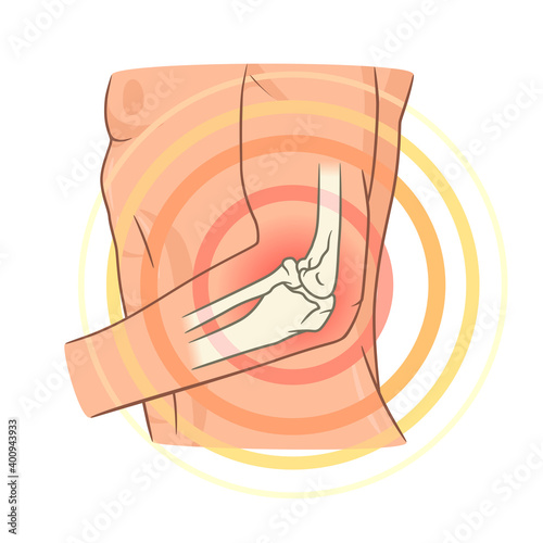 Elbow joint pain