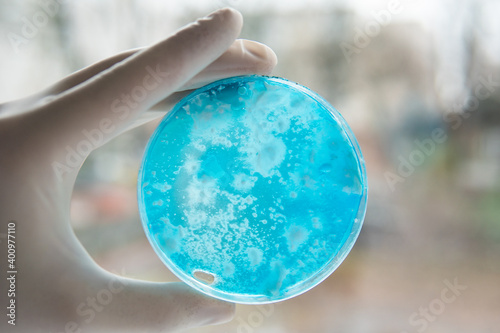 Reishi mushroom mycelium on potato dextrose agar. Fungal mycelium petri dish. photo