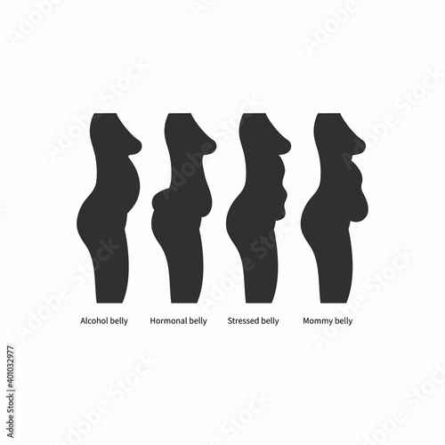 Different types and causes of abdominal obesity in women