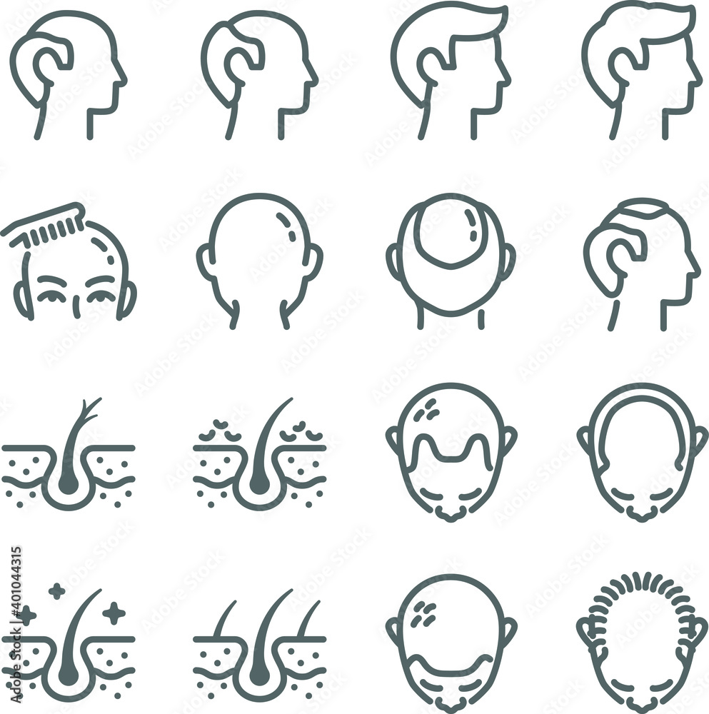 Hair loss icon illustration vector set. Contains such icons as Alopecia, bald, baldness, hair, hairless, loss, scalp, and more. Expanded Stroke Hair loss icon illustration vector set. Contains such icons as Alopecia, bald, baldness, hair, hairless, loss, scalp, and more. Expanded Stroke