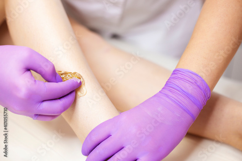 Hair removal at spa depilation studio. Woman legs with sugaring wax and cosmetologist hands in colored rubber gloves. Hot sugar.