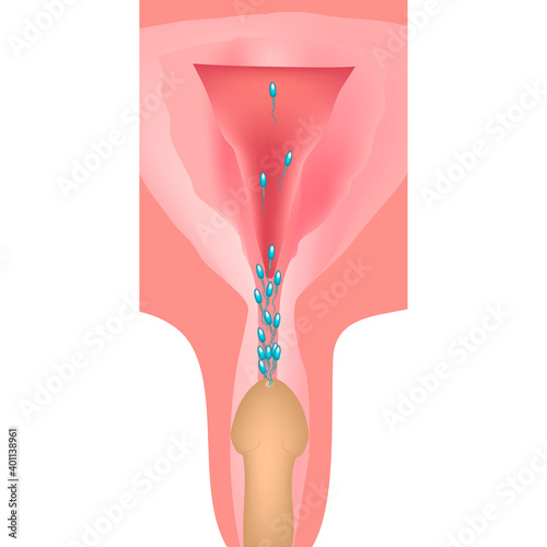 Ejaculation. Ejaculation into the genital tract. The structure of the uterus and ovaries. Vector illustration on isolated background