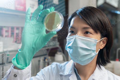 ablesen und überprüfen mikrobiologischer Platten, Direktbeobachtung von Labor Mitarbeiterin in der Mikrobiologie. photo