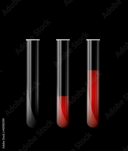 Set of chemical laboratory transparent glass test tubes for chemical experiments on a black background.