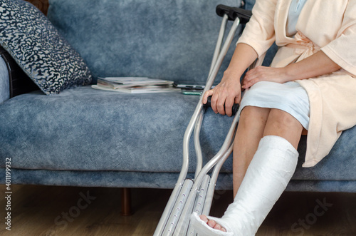 The middle aged woman with broken leg at home