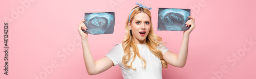 shocked blonde young pregnant woman with ultrasound scan with pizza and fish on pink background, banner.